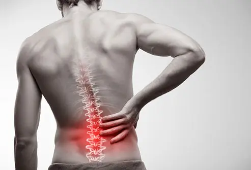 Back Pain: Causes, Symptoms and How It Is Treated